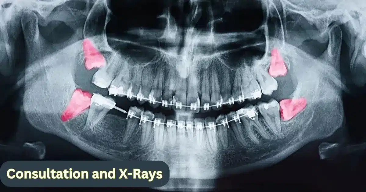 Consultation and X-Rays 