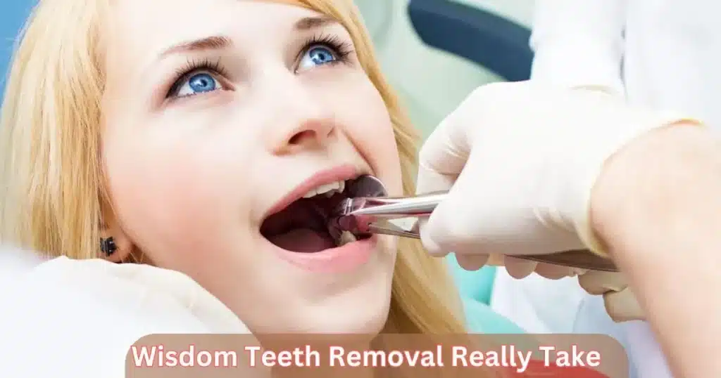 How Much Time Does Wisdom Teeth Removal Really Take?