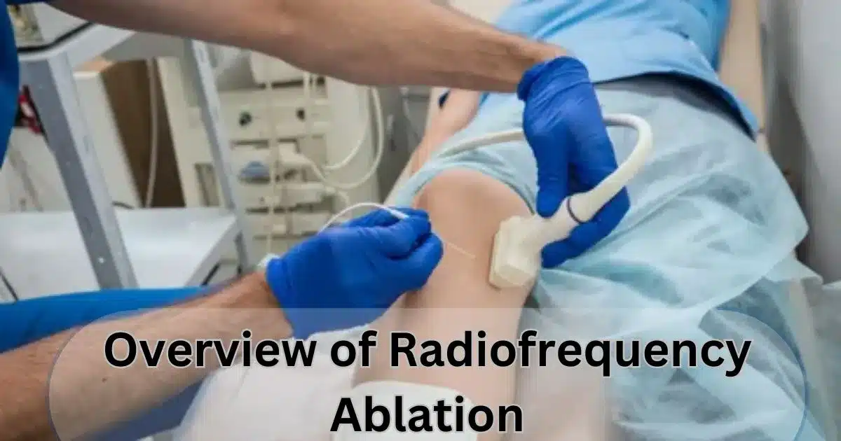 Overview of Radiofrequency Ablation