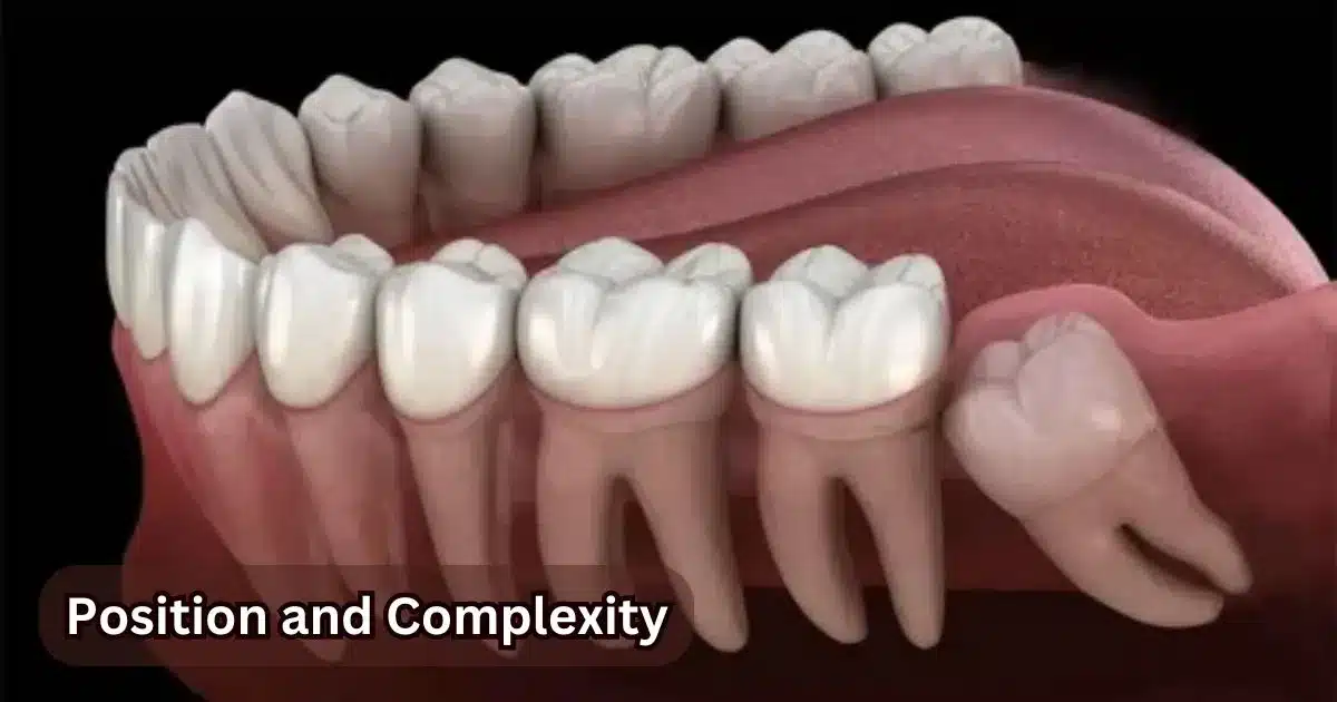 Position and Complexity