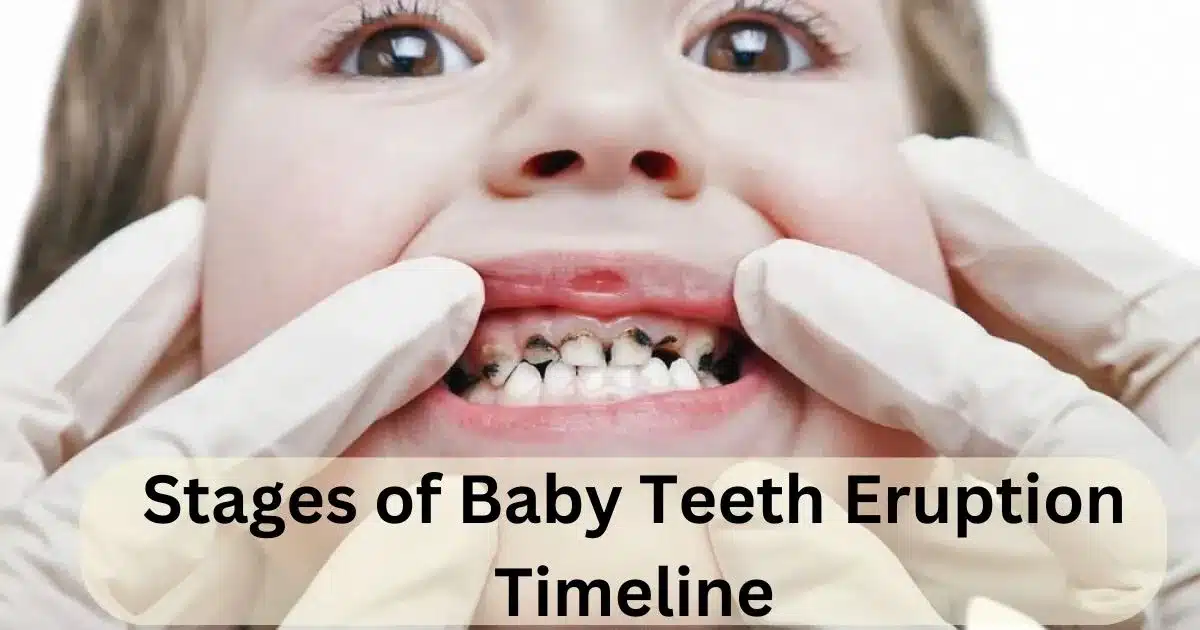 Stages of Baby Teeth Eruption Timeline